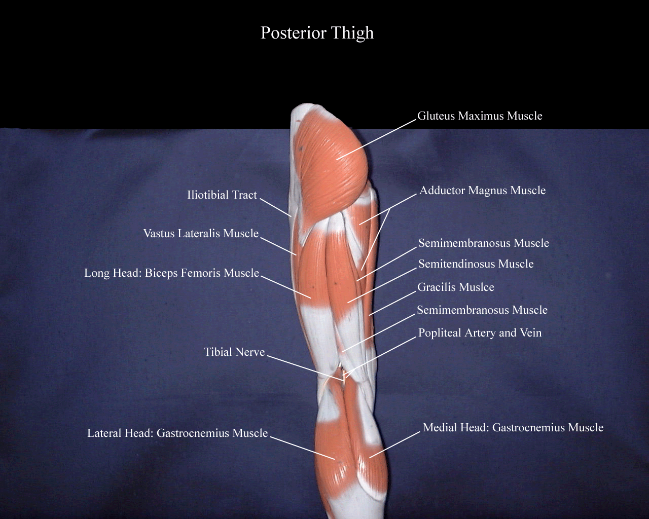 a labeled picture of the posterior thigh on a lower extremity model