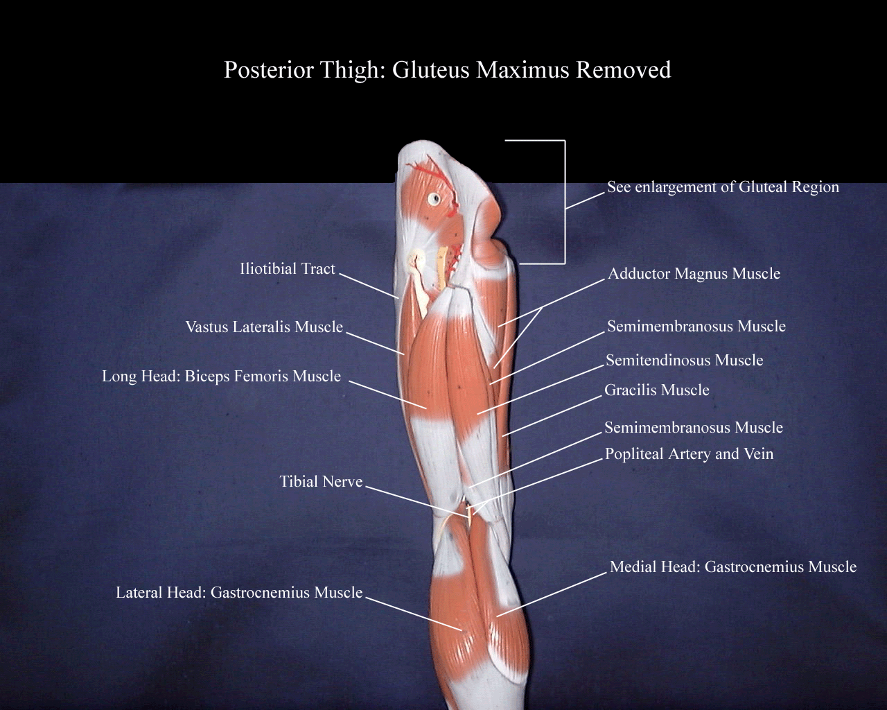 a labeled picture of the posterior thigh on a lower extremity model with the gluteus maximus removed