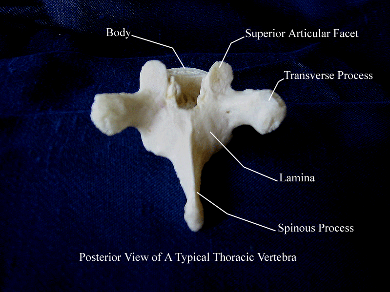 a labeled picture of a posterior view of a thoracic vertebra