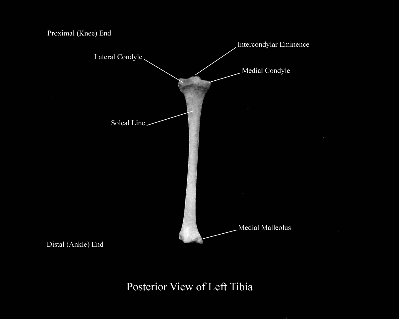 a labeled picture of a posterior view of a left tibia