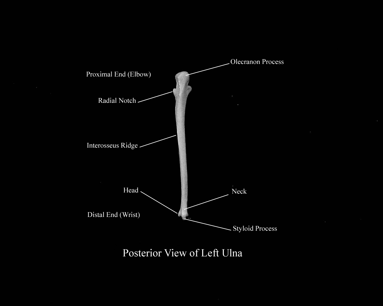 a labeled picture of a posterior view of a left ulna