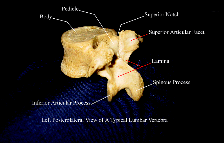 a labeled picture of a lumbar vertebra from a posterior lateral view