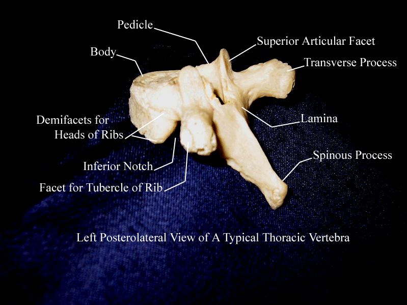 a labeled picture of a thoracic vertebra from a posterior lateral view