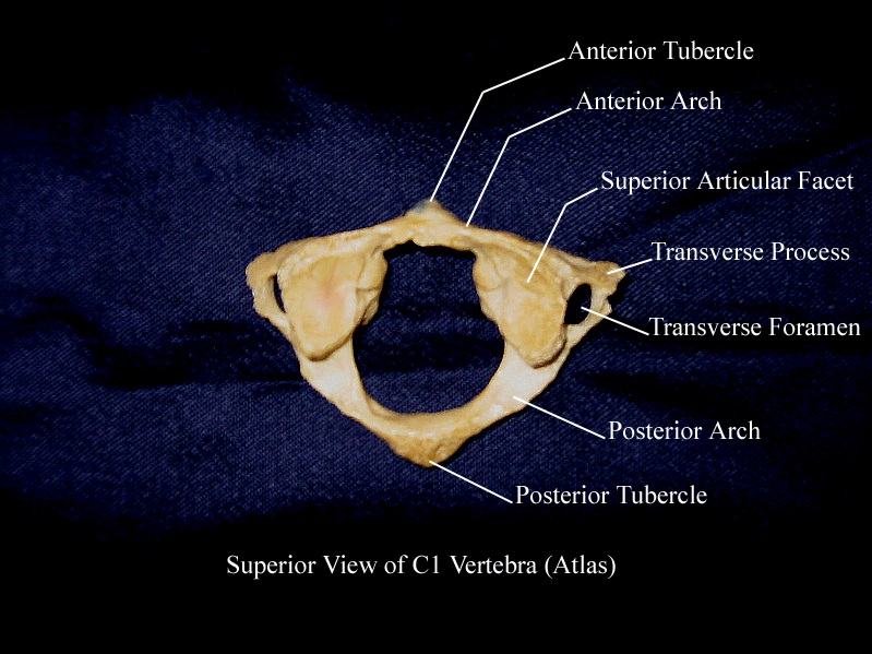 a labeled picture of the first cervical vertebra from a superior view