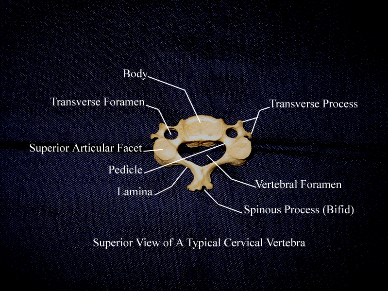 a labeled picture of a superior view af a typical cervical vertebra
