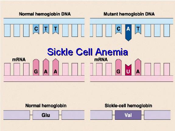 sickle cell anemia mutation