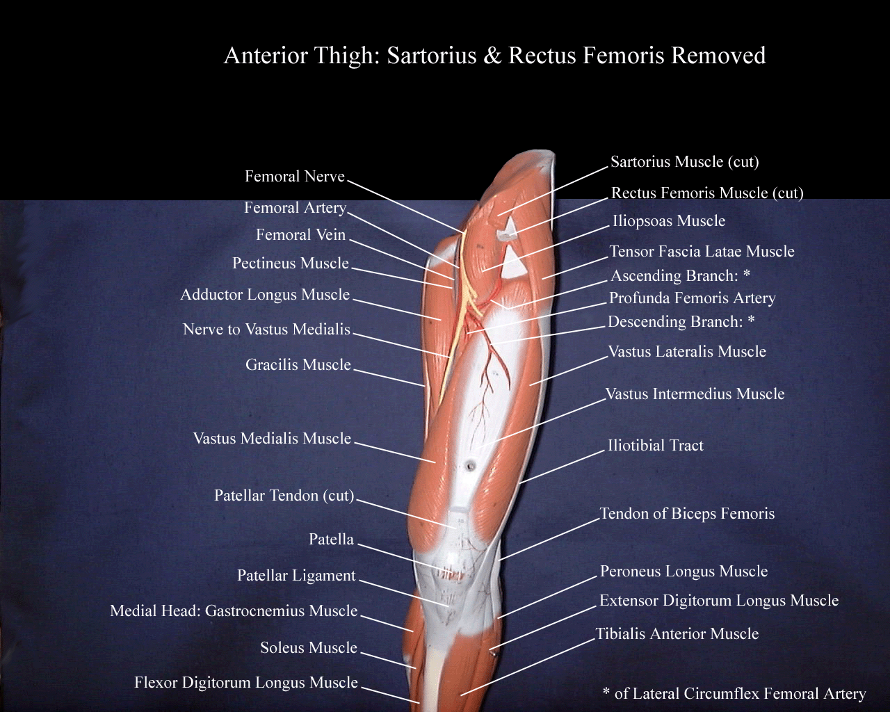 a labeled picture of a lower extremity model indicating the muscles in the deep layer of the anterior thigh