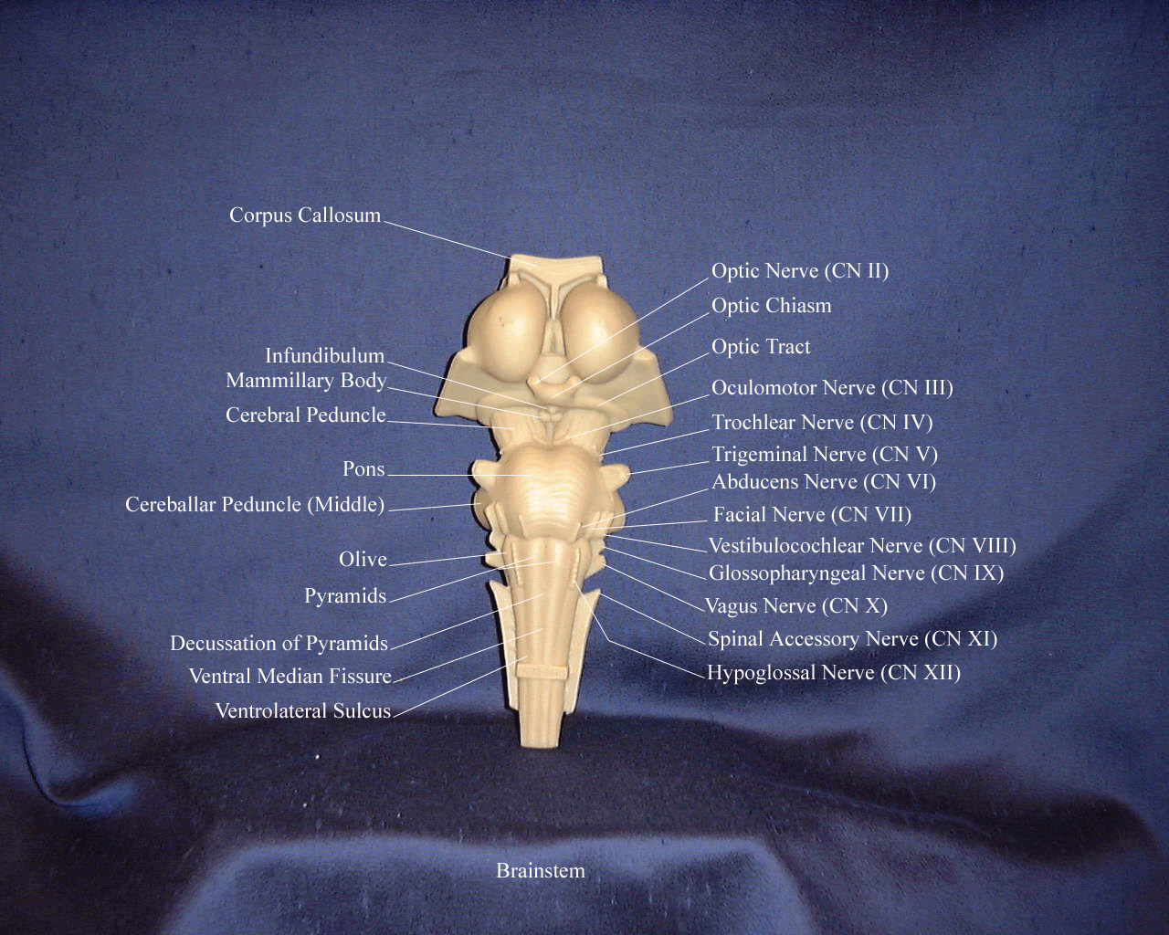 a labeled picture of an anterior view of a brainstem model