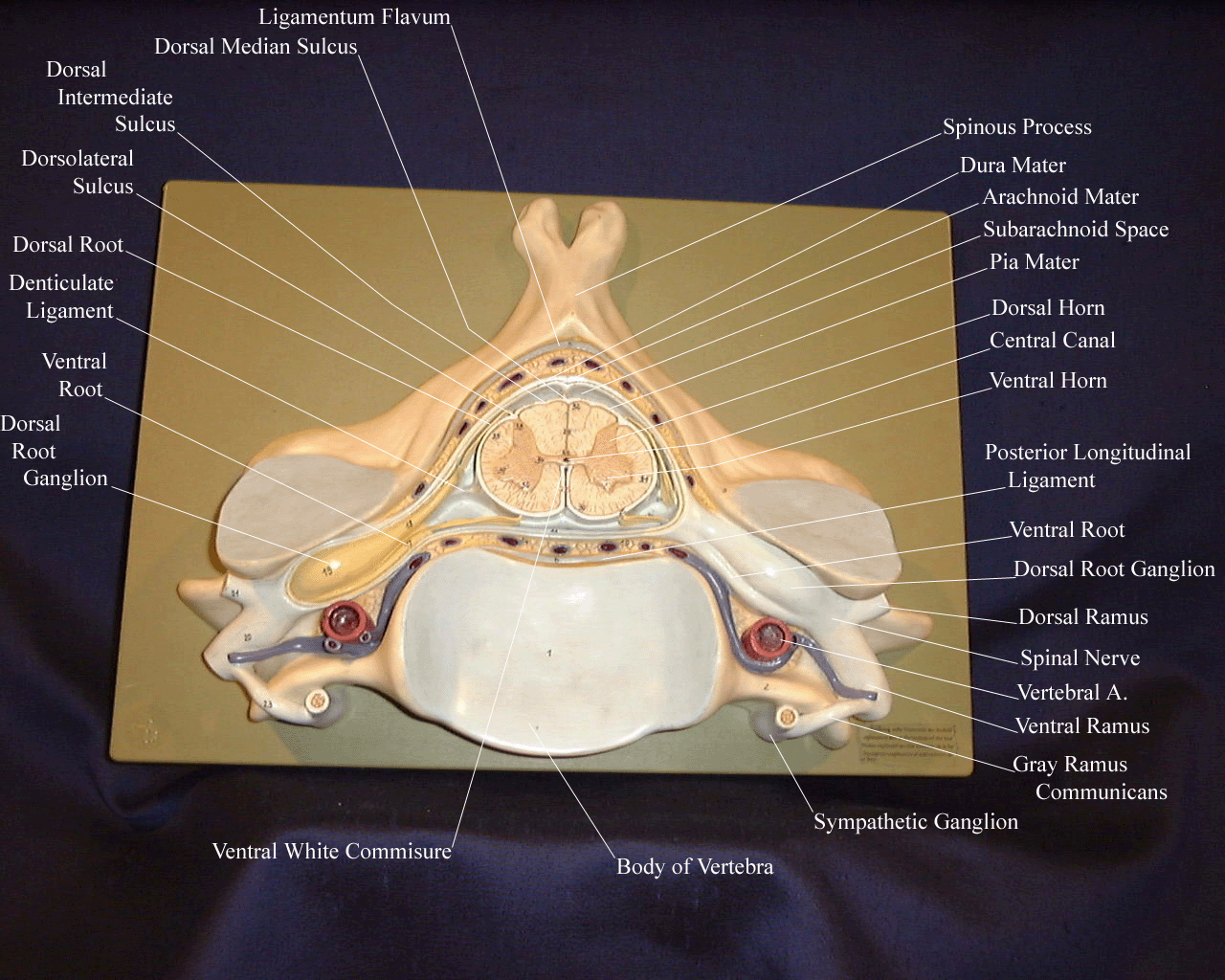 a labeled picture of a model of the spinal cord in the cervical region of the bertebral column
