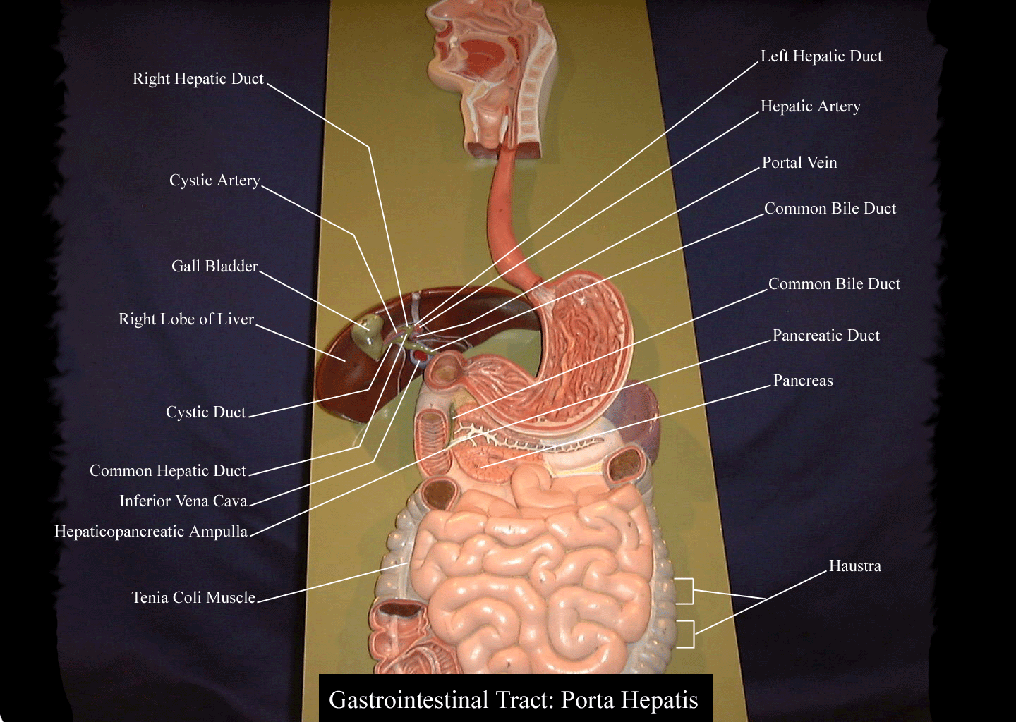 Digestiveplaque2