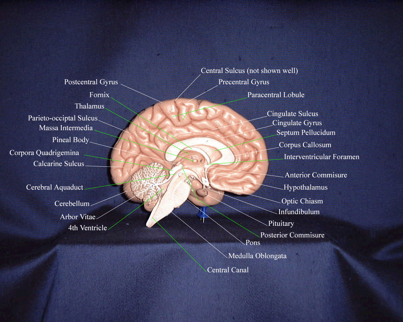 Hypothalamus Model Labeled
