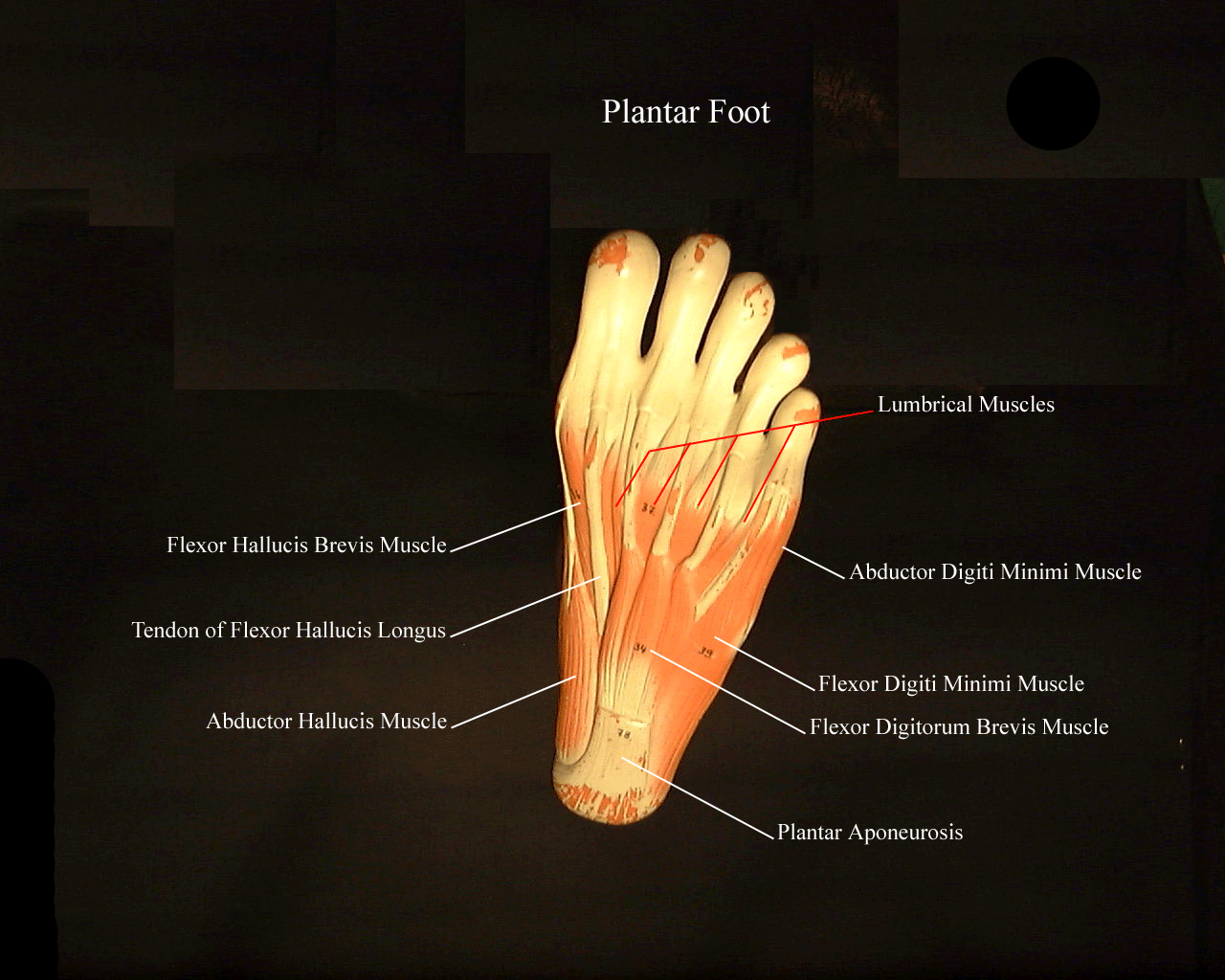 alabeled picture of the plantar surface of the foot on a lower extremity model