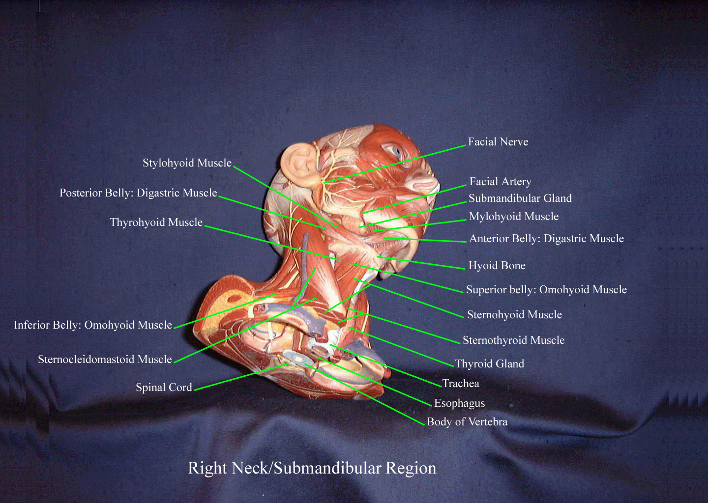 a labeled picture of the muscles of the neck and submandibular region on the right side of a head and neck model